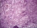 Granultion tissue histology.jpg