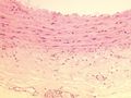 Cardiovascular 3 - large vein.jpg