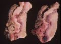 Guttural pouch mycosis.jpg