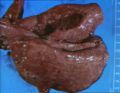 Granulomatous mycotic pneumonia.jpg