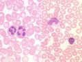 Blood Histology Dragster 2.jpg