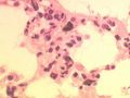 Alveolar macrophages.jpg
