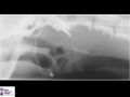 Canine larynx radiograph.jpg