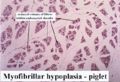 Myofibrillar hypoplasia.jpg