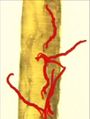 Avian trachea with Syngamus trachea potcast.jpg